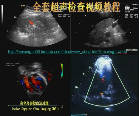 全套超声检查视频教程 B超彩超 超声上岗证培