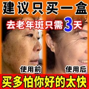 老年斑强力去除手部脸部去斑专用老人，祛斑霜祛黄褐斑雀斑