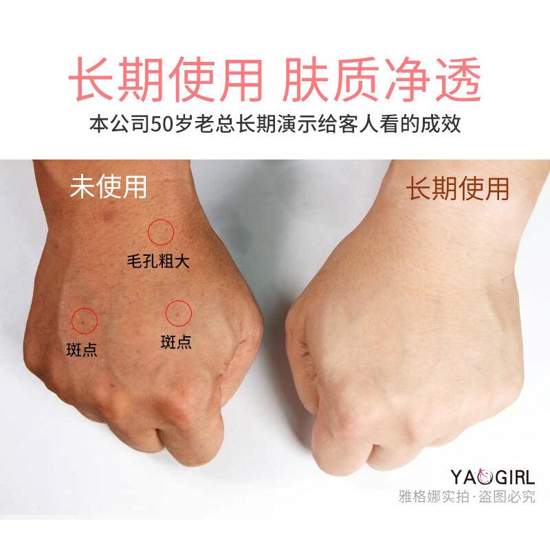 超声波黑头铲脸部美容仪去黑头神器洁面仪毛孔清洁器导出油脂粉刺在类目 个人护理/保健/按摩器材, 清洁美容工具, 电子美容仪中 - 来自Buy2taobao.com提供专业的淘宝代购服务
