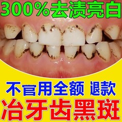 儿童牙jun斑祛除神器去黑色素沉淀清洁黑斑牙黄牙污渍速校美白牙