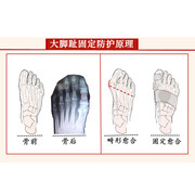 大脚趾骨折夹板护具，大脚趾拇外翻矫正器脚，趾甲受伤跖趾骨折固定