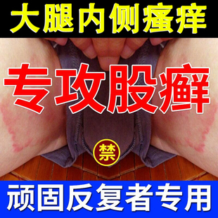 股藓大腿内侧瘙痒湿疹，止痒真菌感染股癣，专用屁股牛皮癣股廯yao膏