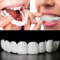 牙缝隙大假牙套牙仿真假牙齿牙缝填充神器门牙缝矫正器大龅牙牙套