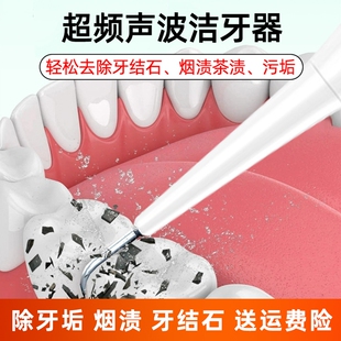 超声波洁牙器牙结石牙垢，去除器牙齿，美白洗牙神器美牙仪口腔镜清除