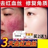 红血丝修复去除脸部角质层薄修复敏感肌肤泛，红淡化大红脸专用面霜