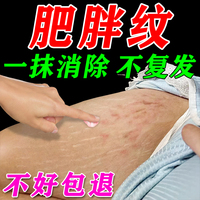 肥胖纹修复霜h消除去肥胖纹生长纹妊辰纹大腿，纹身身体乳液淡化男