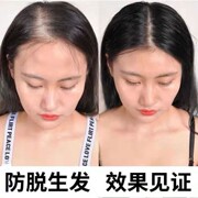 生姜洗发水男女防脱发掉头发增发生发密发育发控油去屑止痒洗发露