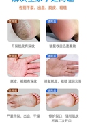 治手裂的药膏防干裂手指脱皮开裂脚后跟干裂真菌感染脚裂防裂专用