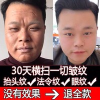 男提拉去皱纹除皱抗衰老面霜，护肤品去去抬头纹，紧致抗皱男士皱