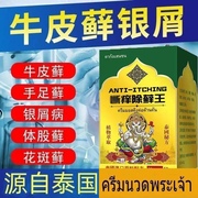 泰国膏牛皮癣银屑病止痒膏，头癣手足癣皮炎湿疹，牛皮癣专用药膏止痒