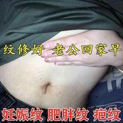 去妊娠纹肚子妊辰纹，产後消除大腿肥胖纹，生长纹预防紧致产後修复霜