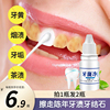 洗牙液洗牙齿污垢除牙石美白速效黄牙洁牙白牙神器剂水去牙渍牙垢