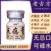 点痣膏无痕净痣膏祛膏，药水美容专用肉去痣神器黑点除志