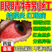 红眼病眼药水止痒消炎杀菌过敏性结膜炎角膜炎滴眼液去红血丝AZ