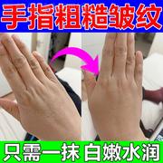 去手指关节皱纹手干燥粗糙手裂纹手黑怎么变白修复嫩肤美白护手霜