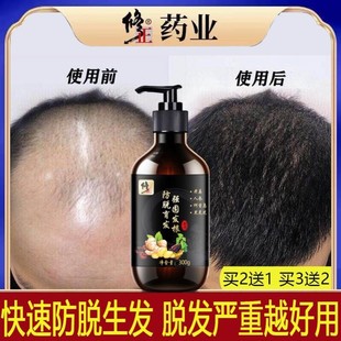 修正防脱生发洗发水增发密发脂溢性发际线秃顶遗传产后脱发育发液