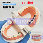 牙科牙模型28颗标准红色牙模型，展示教学医患沟通龋齿蛀牙模型齿科