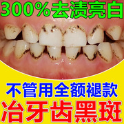 儿童牙菌斑祛除神器去黑色素沉淀清洁黑斑牙黄牙污渍速效美白牙齿