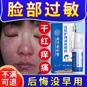 过敏皮肤脸部医用红痒脸上专用激素脸药房同款膏，修复干燥起皮肿yr