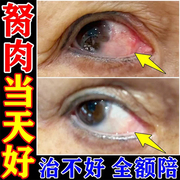 鱼腥草滴眼液朗逸抗菌消炎缓解眼疲劳干眼症状保护眼角膜保持湿润