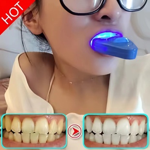 牙齿美白速效去黄牙烟牙菌斑，牙垢黑渍洗牙粉液牙贴牙膏神器白牙素