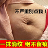 妊辰纹消除去妊娠纹紧致肚皮，淡化肥胖纹，修复霜产后消除疤痕除疤膏