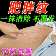 肥胖纹修复霜消除去肥胖纹，生长纹妊辰纹大腿，纹身体乳淡化男女通用