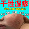 干性湿疹宝宝身体乳儿童婴儿痱子红屁屁抑菌止痒膏皮肤全身保湿霜