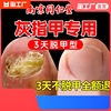 灰指甲脱甲膏软甲膏药贴去除增厚专用修脚脚趾甲脚气抑菌修正