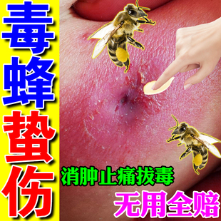 速发马蜂蛰伤药膏蜜蜂蛰伤胡峰叮咬消肿止痒拔毒养蜂专用工具一喷