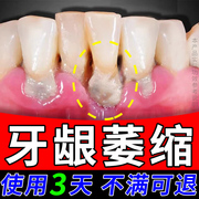 牙龈萎缩牙周炎牙齿松动牙结石缝隙变大口腔清洁护理非修专用牙膏