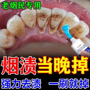 强力去烟渍牙膏去牙渍牙垢黄牙速效牙齿美白一擦即除洗牙膏粉神器