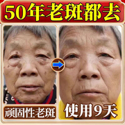 同仁堂祛斑霜祛黄褐斑老年斑强力，去除手部脸部专用