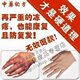 黑玉康肤膏 特效冻疮膏 防 治 冻疮膏 冻疮 特效 药 中药 特 消