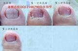 ��ָ��(������3G+10ML����Һ+��Ƭ+����)��ָ��49Ԫ1����ָ��