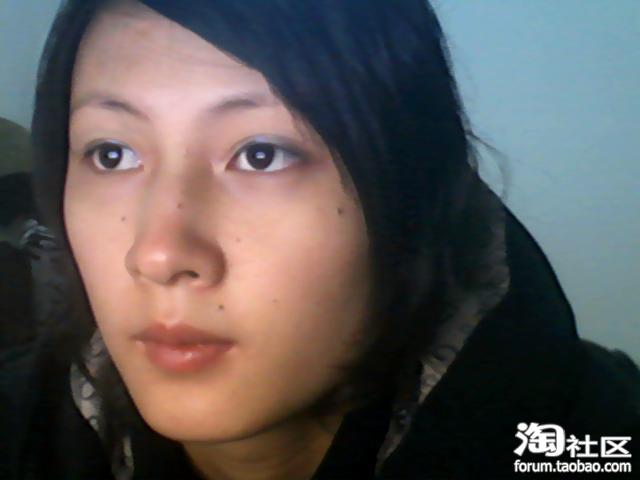 急。我<em>脸上</em>的痣很多,<em>怎么办</em>啊? - 消灭痘痘油光