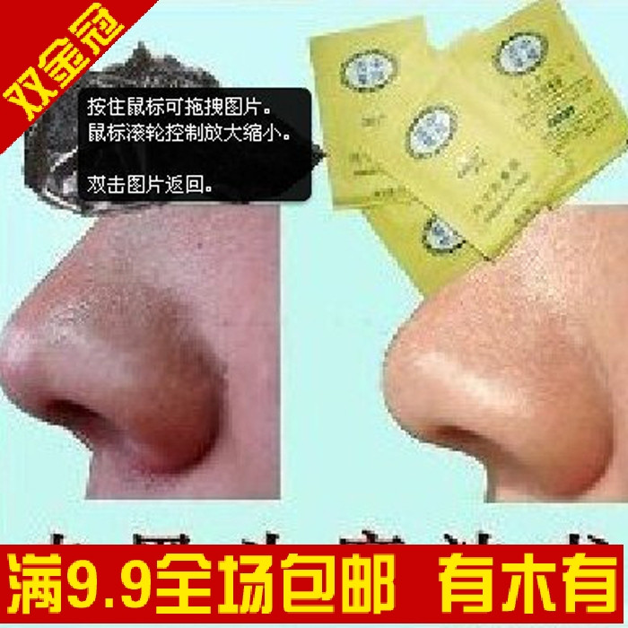 超强神奇去黑头中华百草纯中药鼻膜/鼻贴中药调理只需1元