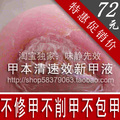 甲本清速效新甲液 灰指甲专用特效药 无需削甲无需包甲无效退款