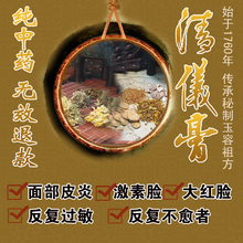 清仪膏2型祖传中药秘方激素脸面膜皮炎反复过敏敏感肌肤无效退款
