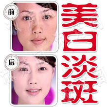 美白淡斑去痘印 去疤痕 去痘印 去痘疤  雀斑 美白淡斑霜